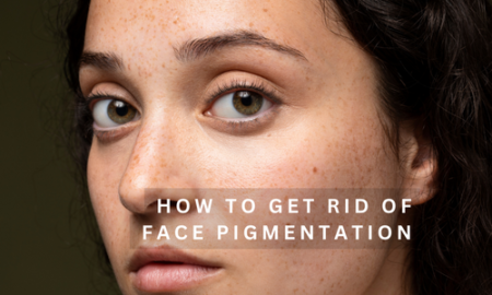 HOW TO GET RID OF FACE PIGMENTATION